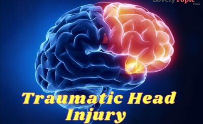 Traumatic Head Injury Treatment
